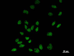 Immunocytochemistry/ Immunofluorescence - Anti-CA150 antibody [TCEAD79A] (AB50812)
