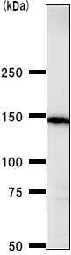 Western blot - Anti-CA150 antibody [TCEAD79A] (AB50812)