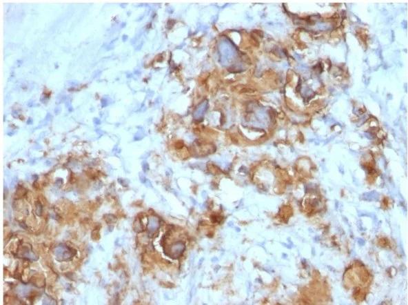 Immunohistochemistry (Formalin/PFA-fixed paraffin-embedded sections) - Anti-CA19-9 antibody [121SLE] (AB286184)