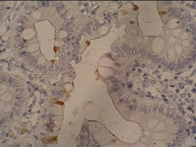 Immunohistochemistry (Formalin/PFA-fixed paraffin-embedded sections) - Anti-CA19-9 antibody [121SLE] (AB3982)