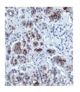 Immunohistochemistry (Formalin/PFA-fixed paraffin-embedded sections) - Anti-CA19-9 antibody [GT933] (AB289665)
