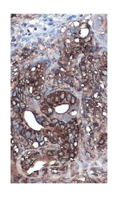 Immunohistochemistry (Formalin/PFA-fixed paraffin-embedded sections) - Anti-CA19-9 antibody [GT933] (AB289665)