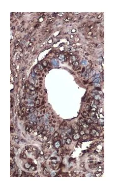 Immunohistochemistry (Formalin/PFA-fixed paraffin-embedded sections) - Anti-CA19-9 antibody [GT933] (AB289665)