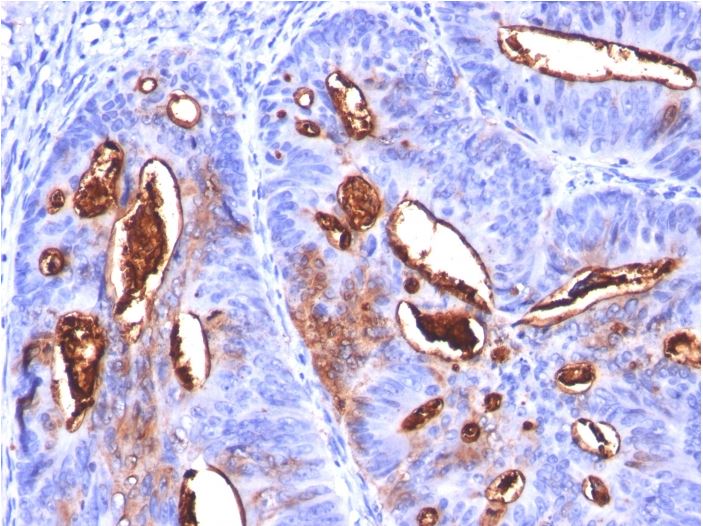 Immunohistochemistry (Formalin/PFA-fixed paraffin-embedded sections) - Anti-CA19-9 antibody [SPM588] (AB270734)