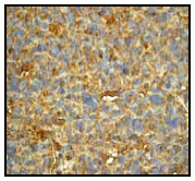 Immunohistochemistry (Formalin/PFA-fixed paraffin-embedded sections) - Anti-CAB39/MO25 antibody [EP1680Y] (AB51132)