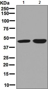 Western blot - Anti-CABP antibody [EPR7916] (AB128910), expandable thumbnail