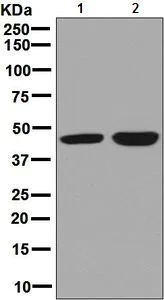 Western blot - Anti-CABP antibody [EPR7916] - BSA and Azide free (AB248215)