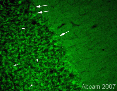 Immunohistochemistry (PFA perfusion fixed frozen sections) - Anti-CACNA1A antibody (AB32642)