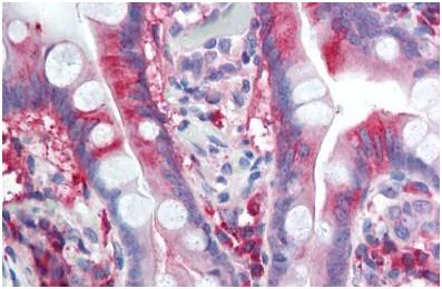 Immunohistochemistry (Formalin/PFA-fixed paraffin-embedded sections) - Anti-CACNA1C antibody (AB140760)