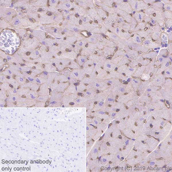 Immunohistochemistry (Formalin/PFA-fixed paraffin-embedded sections) - Anti-CACNA1C antibody [EPR22625-61] (AB234438), expandable thumbnail