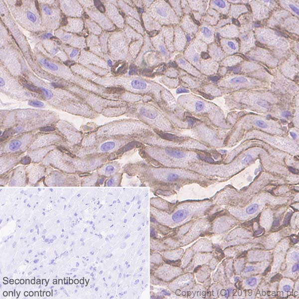 Immunohistochemistry (Formalin/PFA-fixed paraffin-embedded sections) - Anti-CACNA1C antibody [EPR22625-61] (AB234438), expandable thumbnail