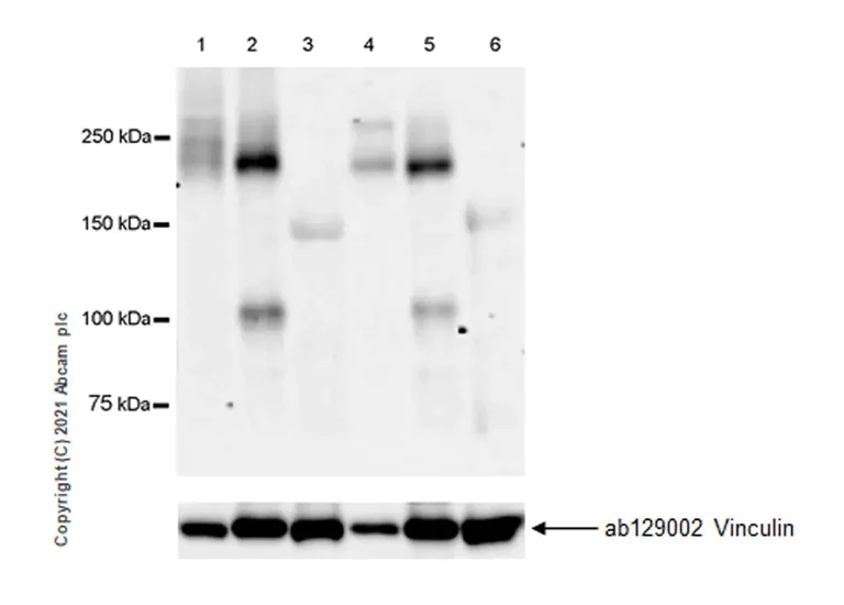 Western blot - Anti-CACNA1C antibody [EPR24535-131] - BSA and Azide free (AB283581)