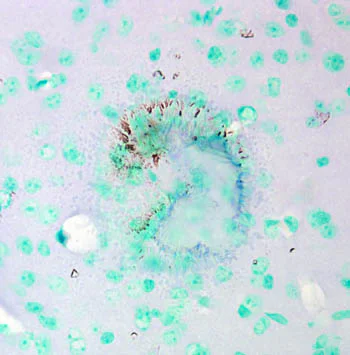 Immunohistochemistry (Formalin/PFA-fixed paraffin-embedded sections) - Anti-CACNA1C antibody [S57] (AB84814)