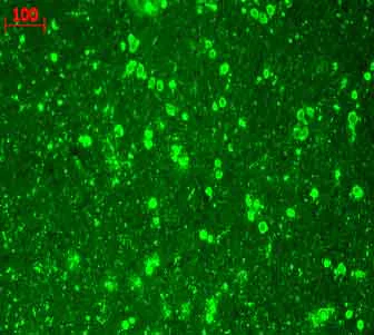 Immunohistochemistry (Formalin/PFA-fixed paraffin-embedded sections) - Anti-CACNA1C antibody [S57] (AB84814)