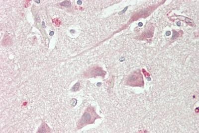 Immunohistochemistry (Formalin/PFA-fixed paraffin-embedded sections) - Anti-CACNA1E antibody (AB230640)
