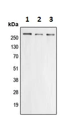 Western blot - Anti-CACNA1E antibody (AB230640)