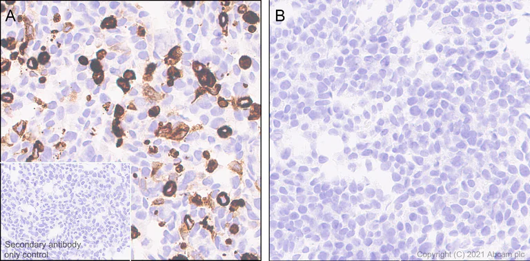Immunohistochemistry (Formalin/PFA-fixed paraffin-embedded sections) - Anti-CACNA1E antibody [EPR25385-129] (AB288766)