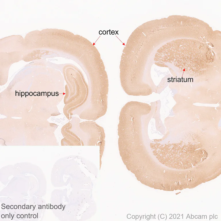 Immunohistochemistry (Formalin/PFA-fixed paraffin-embedded sections) - Anti-CACNA1E antibody [EPR25385-129] (AB288766)