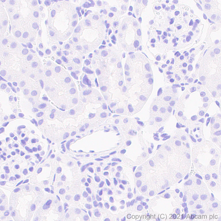Immunohistochemistry (Formalin/PFA-fixed paraffin-embedded sections) - Anti-CACNA1E antibody [EPR25385-129] - BSA and Azide free (AB288772)