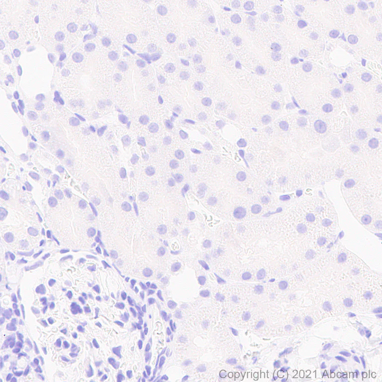 Immunohistochemistry (Formalin/PFA-fixed paraffin-embedded sections) - Anti-CACNA1E antibody [EPR25385-129] - BSA and Azide free (AB288772)