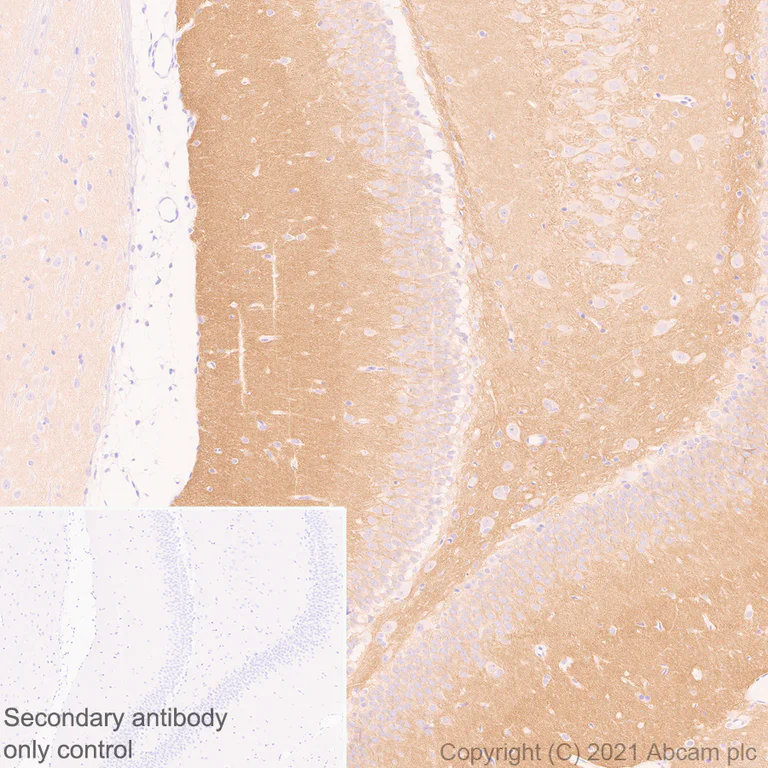 Immunohistochemistry (Formalin/PFA-fixed paraffin-embedded sections) - Anti-CACNA1E antibody [EPR25385-129] - BSA and Azide free (AB288772)