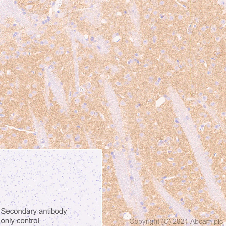 Immunohistochemistry (Formalin/PFA-fixed paraffin-embedded sections) - Anti-CACNA1E antibody [EPR25385-129] - BSA and Azide free (AB288772)