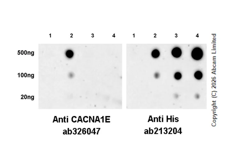 Dot Blot - Anti-CACNA1E antibody [EPR29576-25] (AB326047)