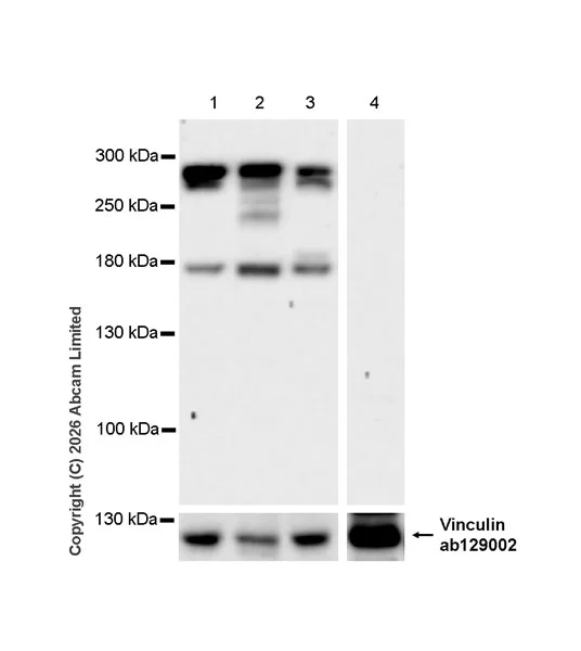 Western blot - Anti-CACNA1E antibody [EPR29576-25] (AB326047)