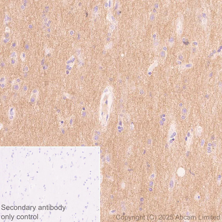 Immunohistochemistry (Formalin/PFA-fixed paraffin-embedded sections) - Anti-CACNA1E antibody [EPR29576-34] (AB325754)