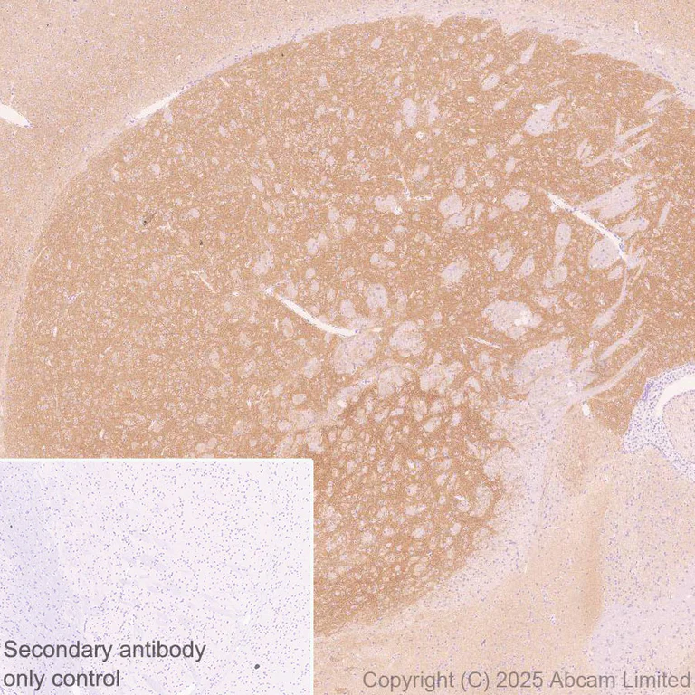 Immunohistochemistry (Formalin/PFA-fixed paraffin-embedded sections) - Anti-CACNA1E antibody [EPR29576-34] (AB325754)