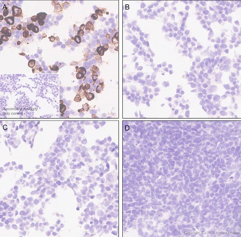 Immunohistochemistry (Formalin/PFA-fixed paraffin-embedded sections) - Anti-CACNA1E antibody [EPR29576-34] (AB325754)