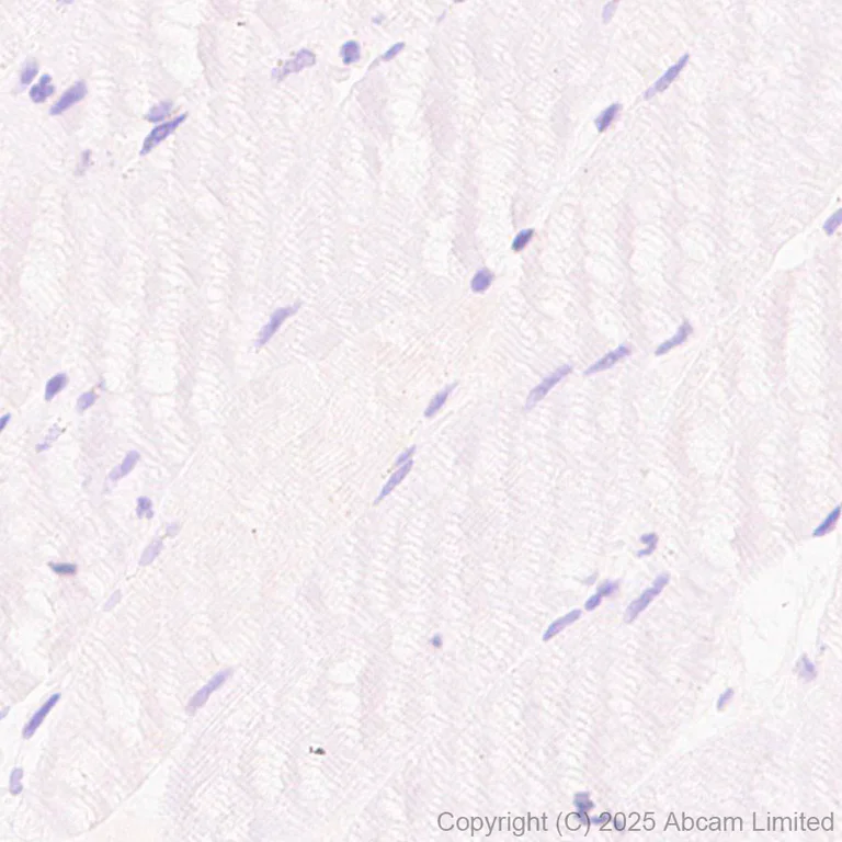 Immunohistochemistry (Formalin/PFA-fixed paraffin-embedded sections) - Anti-CACNA1E antibody [EPR29576-34] (AB325754)