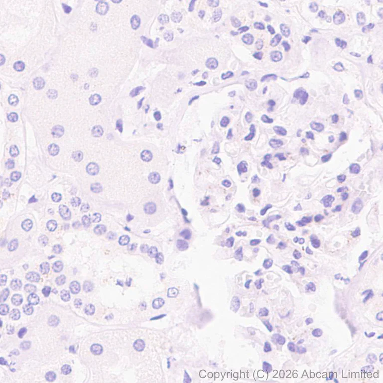 Immunohistochemistry (Formalin/PFA-fixed paraffin-embedded sections) - Anti-CACNA1E antibody [EPR29576-34] (AB325754)