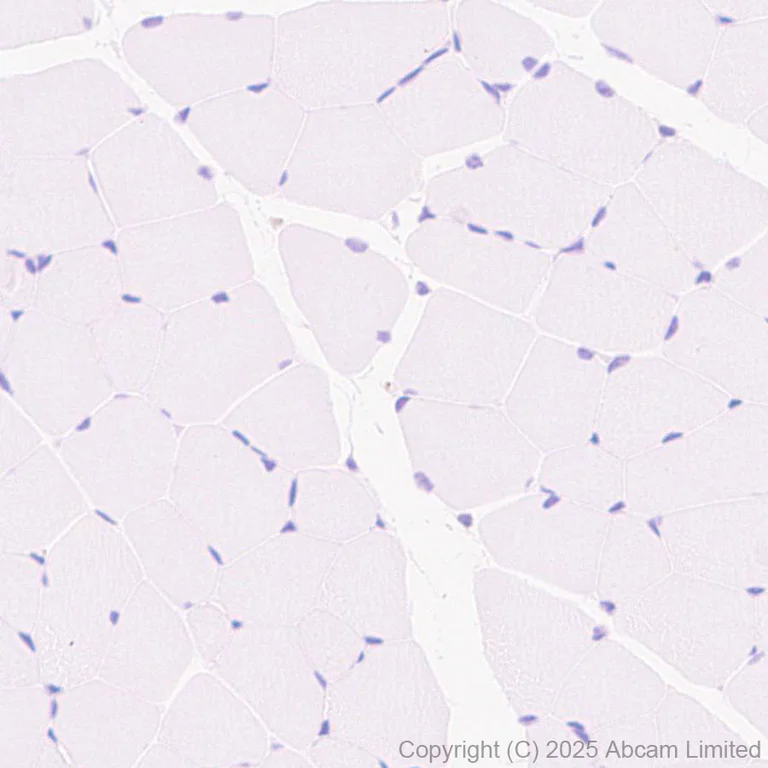 Immunohistochemistry (Formalin/PFA-fixed paraffin-embedded sections) - Anti-CACNA1E antibody [EPR29576-34] (AB325754)