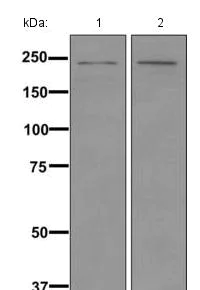 Western blot - Anti-CACNA1F antibody [EPR11822] (AB171968)