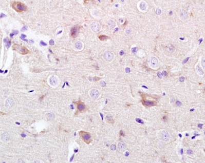 Immunohistochemistry (Formalin/PFA-fixed paraffin-embedded sections) - Anti-CACNA1G antibody (AB203577)