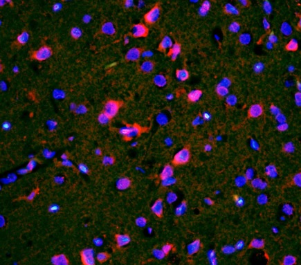 Immunohistochemistry (Formalin/PFA-fixed paraffin-embedded sections) - Anti-CACNA1G antibody (AB203577)