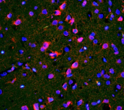 Immunohistochemistry (Formalin/PFA-fixed paraffin-embedded sections) - Anti-CACNA1G antibody (AB203577)