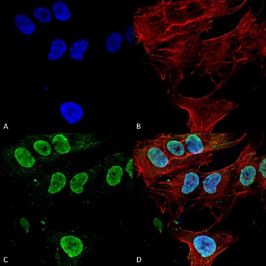 Immunocytochemistry/ Immunofluorescence - Anti-CACNA1G antibody [N178A/9] (AB134269)