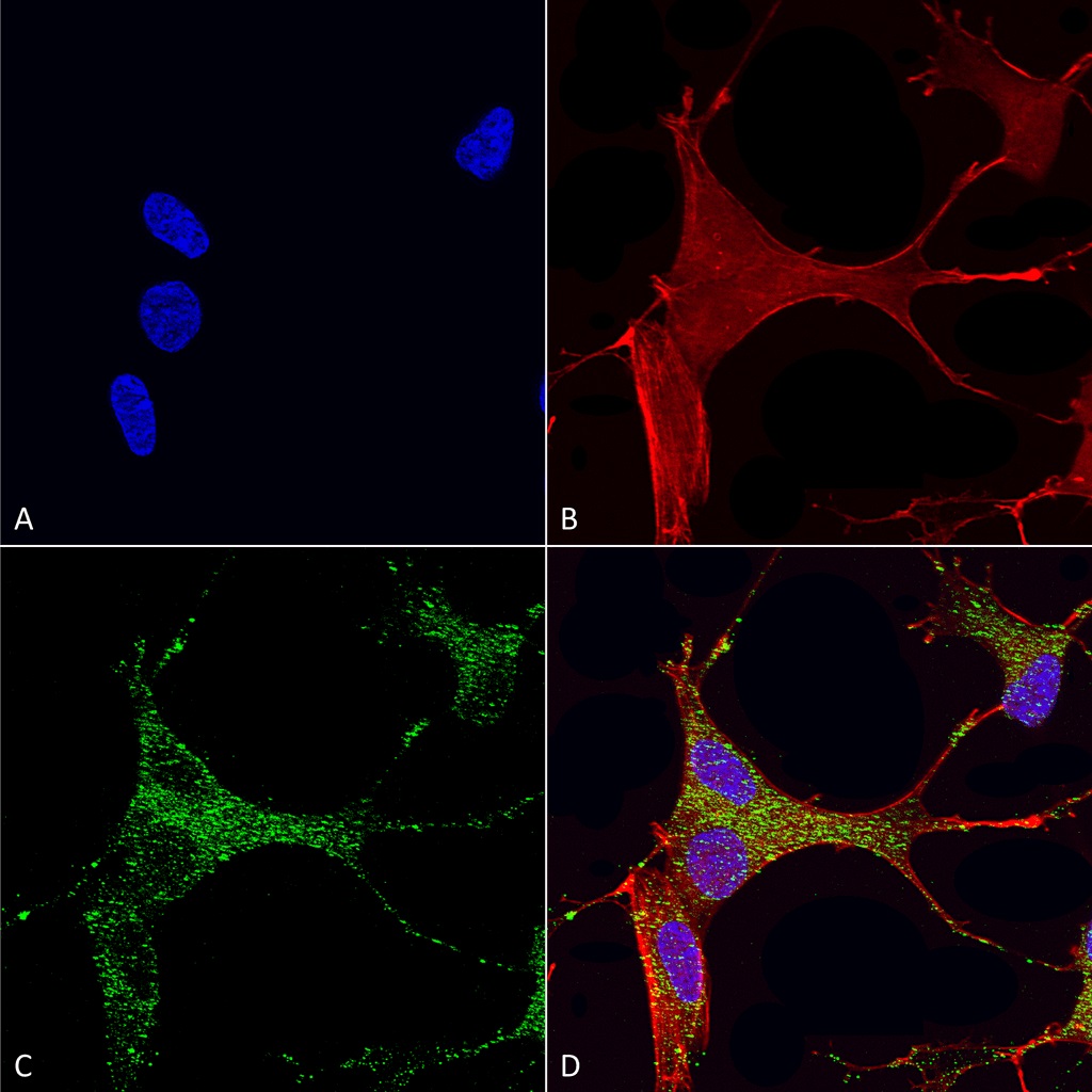 Immunocytochemistry/ Immunofluorescence - Anti-CACNA1G antibody [N178A/9] (AB134269)