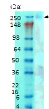 Western blot - Anti-CACNA1G antibody [N178A/9] (AB134269)