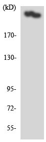 Western blot - Anti-CACNA1H antibody (AB135974), expandable thumbnail