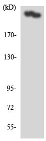 Western blot - Anti-CACNA1H antibody (AB135974)