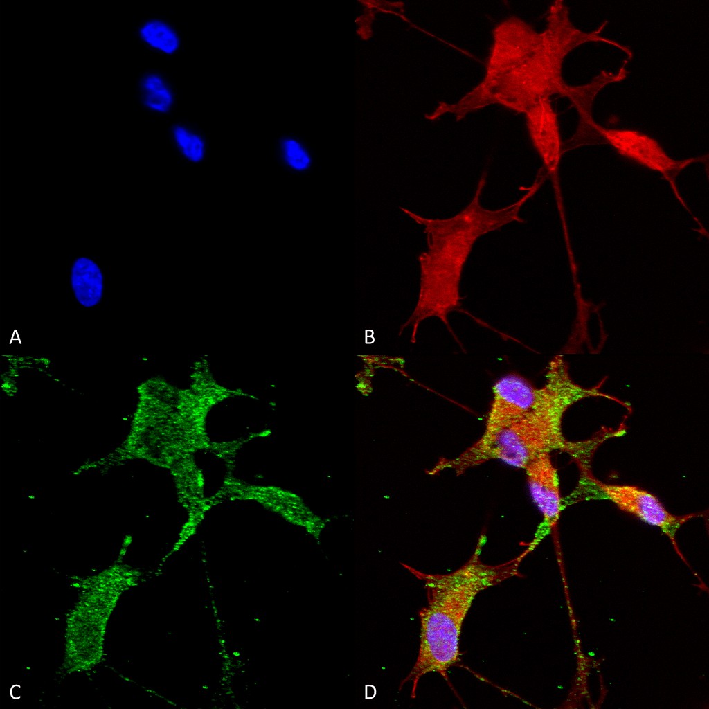 Immunocytochemistry/ Immunofluorescence - Anti-CACNA1H antibody [N55/10] (AB84815)