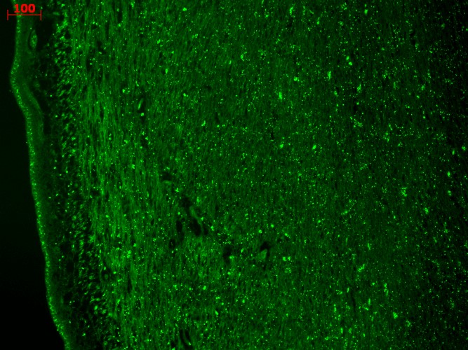 Immunohistochemistry (Formalin/PFA-fixed paraffin-embedded sections) - Anti-CACNA1H antibody [N55/10] (AB84815), expandable thumbnail