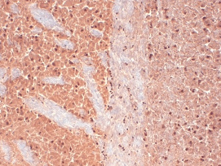 Immunohistochemistry (Frozen sections) - Anti-CACNA1H antibody [N55/10] (AB84815), expandable thumbnail