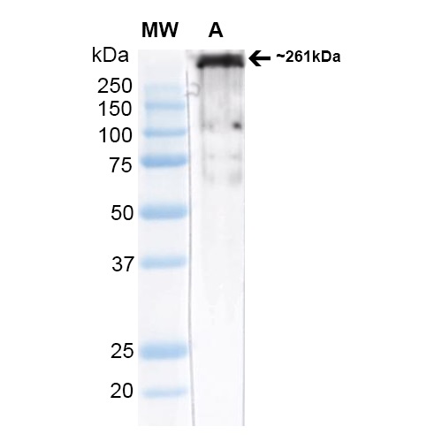 Western blot - Anti-CACNA1H antibody [N55/10] (AB84815), expandable thumbnail