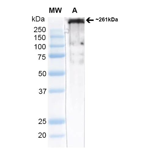 Western blot - Anti-CACNA1H antibody [N55/10] (AB84815)