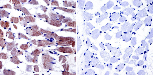 Immunohistochemistry (Formalin/PFA-fixed paraffin-embedded sections) - Anti-CACNA1S antibody [1A] (AB2862)