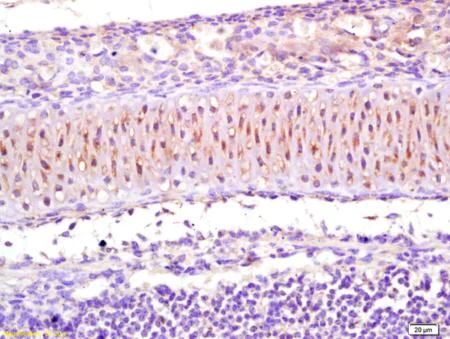 Immunohistochemistry (Formalin/PFA-fixed paraffin-embedded sections) - Anti-CACNA1S antibody (AB203662)